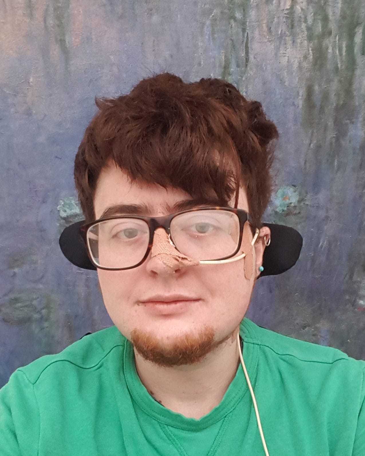 Jamie is looking directly at the camera, wearing glasses, and a green t-shirt. Jamie has thick red hair, a beard, two ear piercings, and a nasal tube.